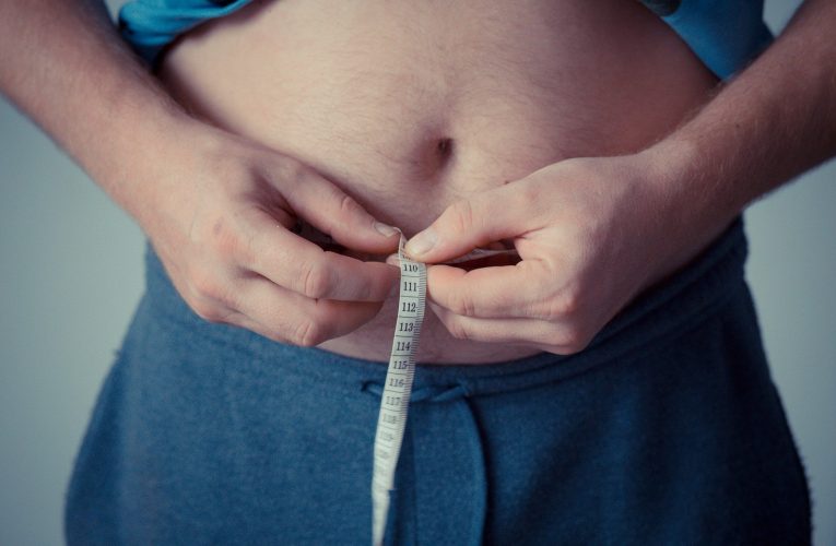 비만은 습관 아닌 질환… 비만의 모든 것 9문9답