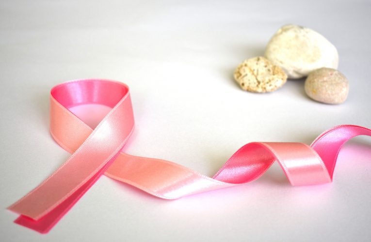 진단·치료·재건 다 잡아야 하는 유방암